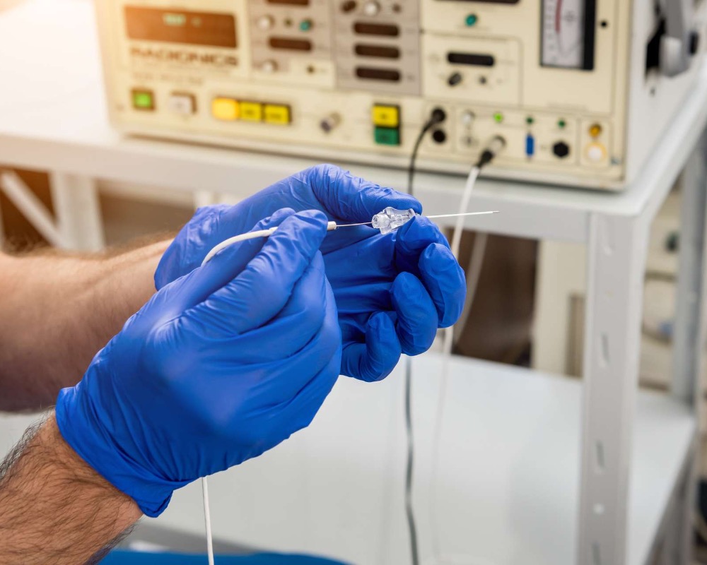 RFA Therapy for Varicose Veins What Are the Side Effects? Vein